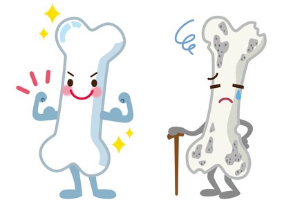 骨折しやすくなる骨粗しょう症