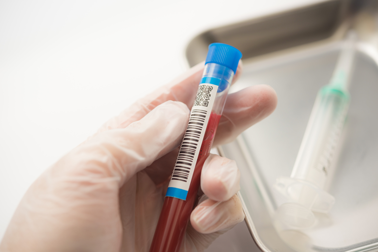 再生医療(PRP療法)